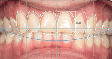 exocad Smile Creator (Perpetual Initial Purchase)